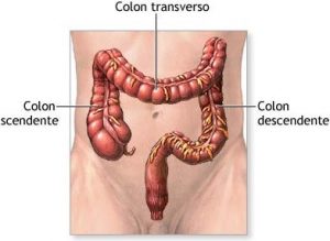 Desajustes del colon